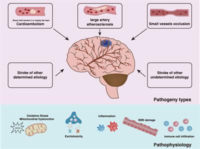 Microglia autophagy in ischemic stroke: A double-edged sword